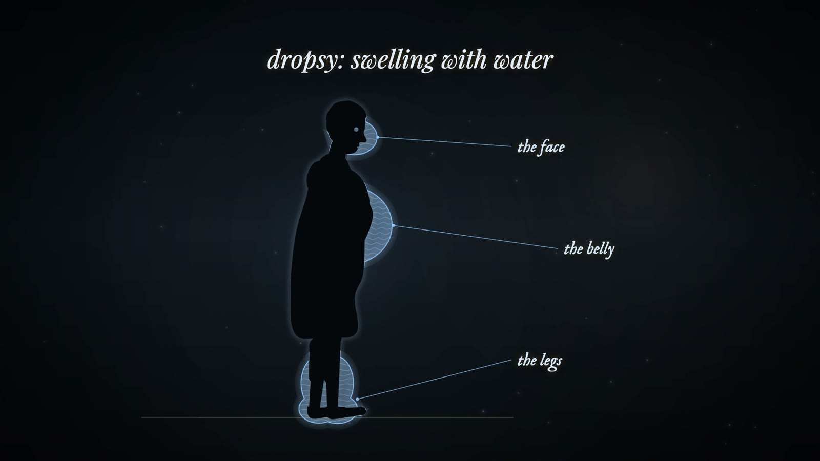 Silhouette of a standing figure in profile with blue water-filled swellings at the face, belly and legs, titled dropsy: swelling with water.