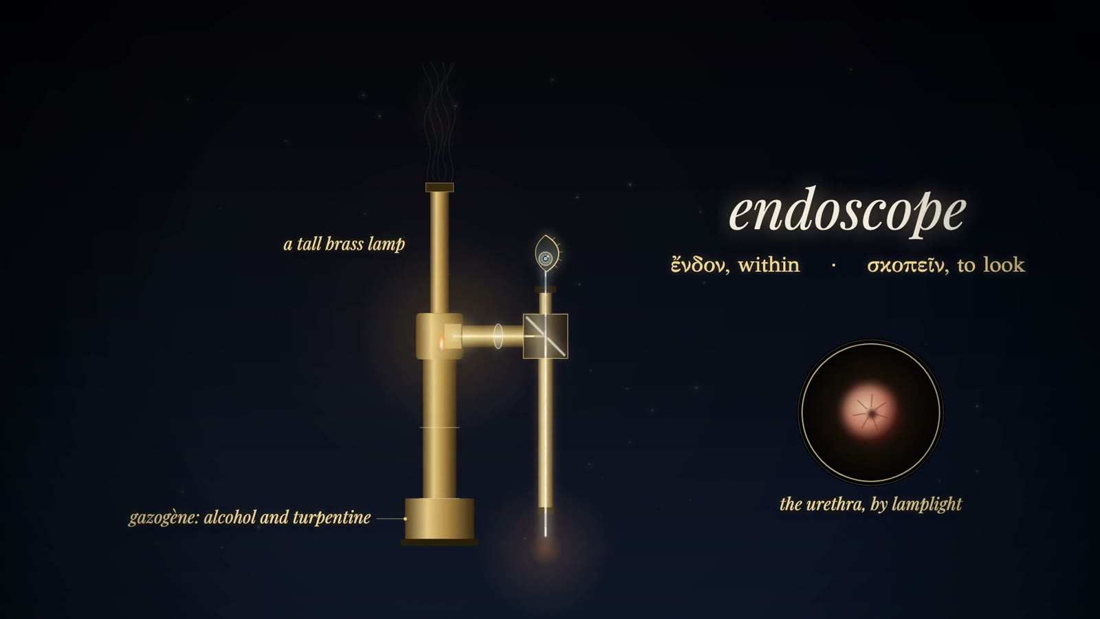 Tall brass lamp, a lens and a mirror block feeding a vertical tube with an eye at the top, labelled endoscope, with an inset of the urethra by lamplight.
